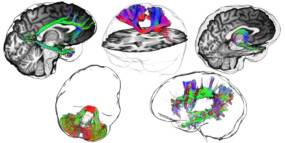 Silhouette shading | The Neuro Bureau